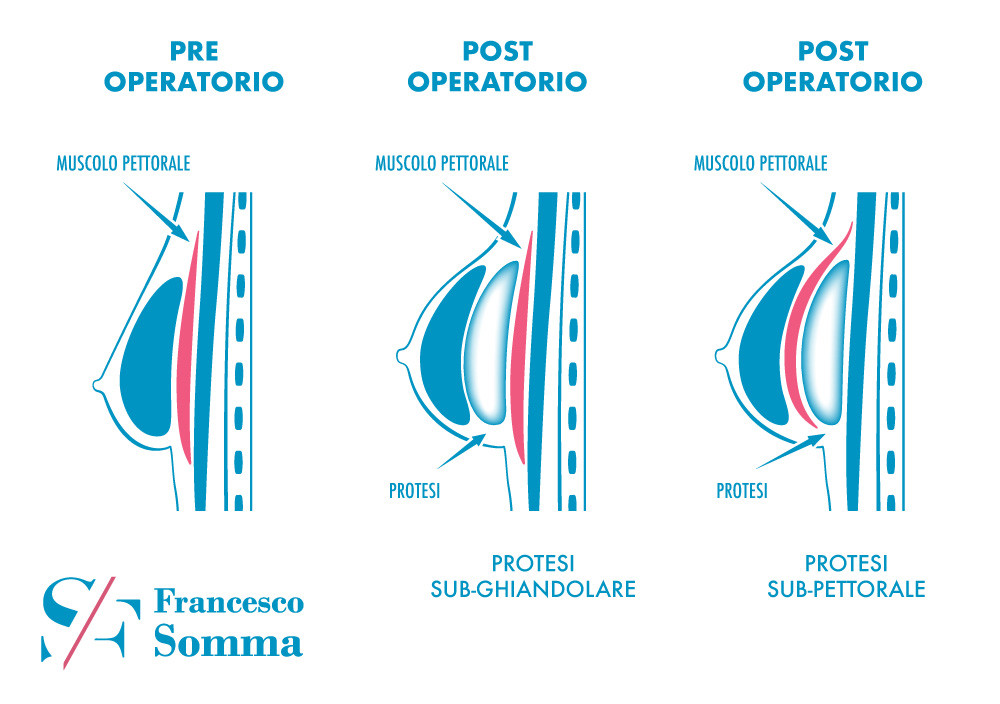 Dr. Francesco Somma